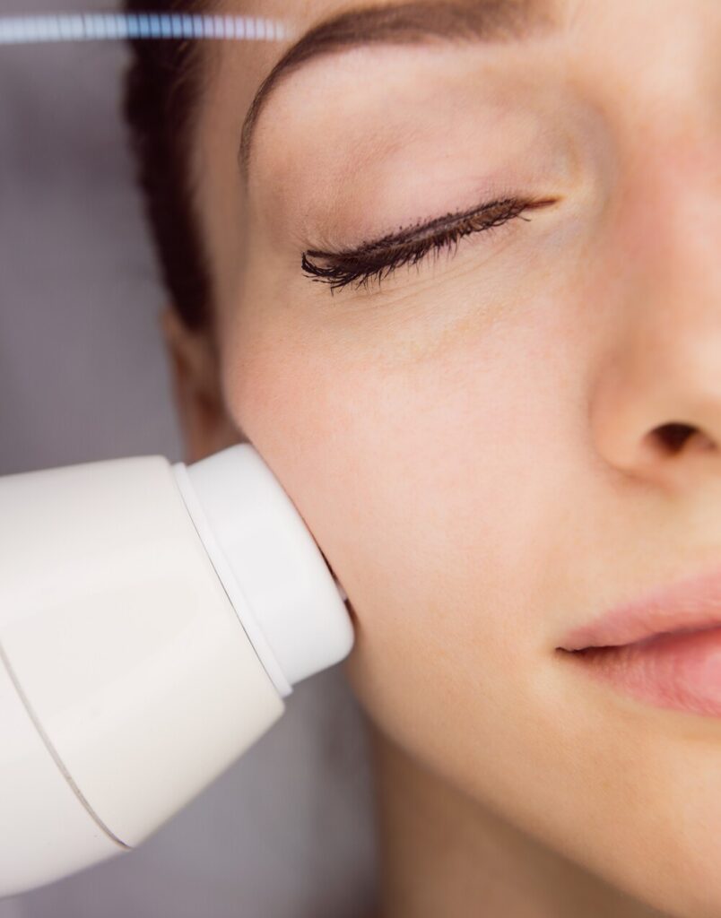 tratamiento hifu liftera en clinica estetica