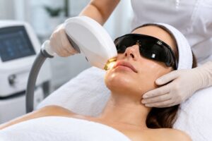 tratamiento ipl luz pulsada intensa